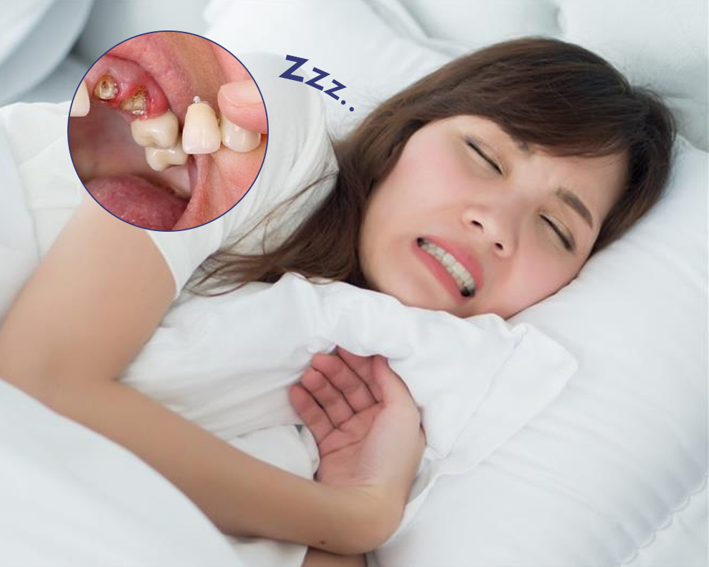 chiêm bao thấy rụng răng có chảy máu