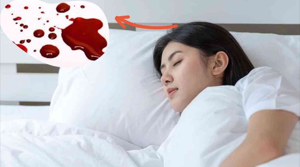 mo chay mau mui 3795