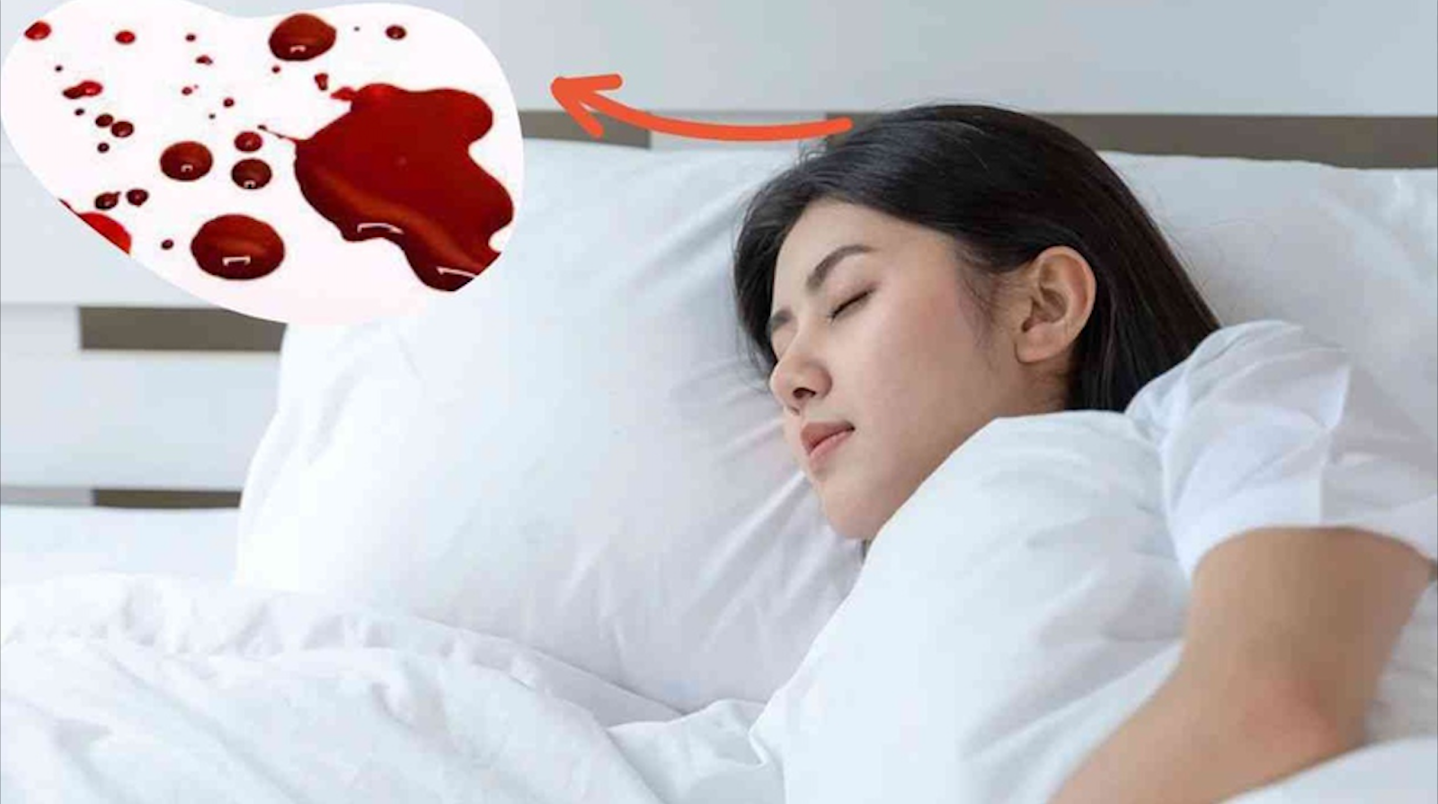 Nằm mơ thấy máu là điềm gì? Giải mã chi tiết A-Z 2026 2 nằm mơ thấy máu của chính mình