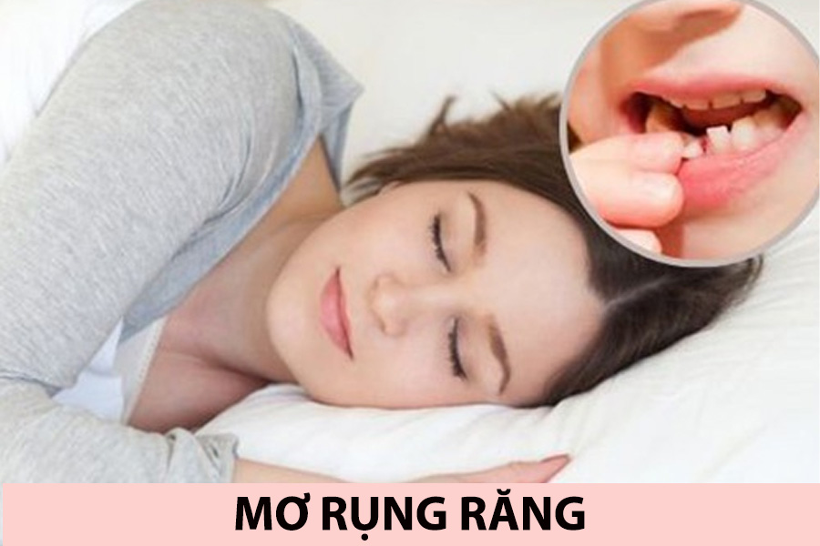 mơ thấy nhổ một lúc nhiều răng