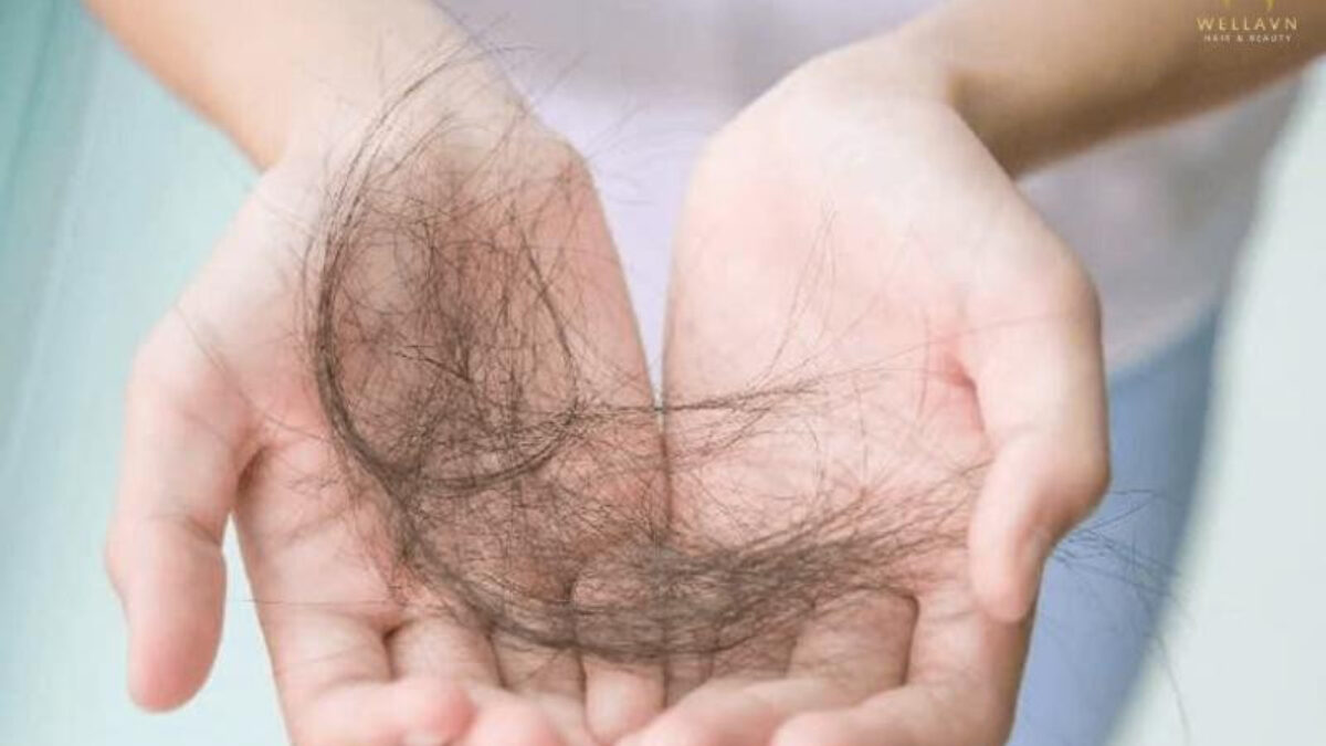 nằm mơ thấy rụng tóc